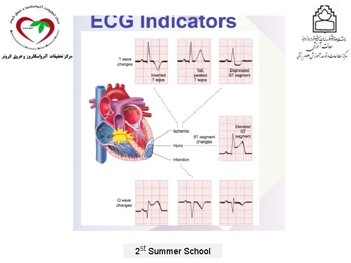 2 st Summer School 