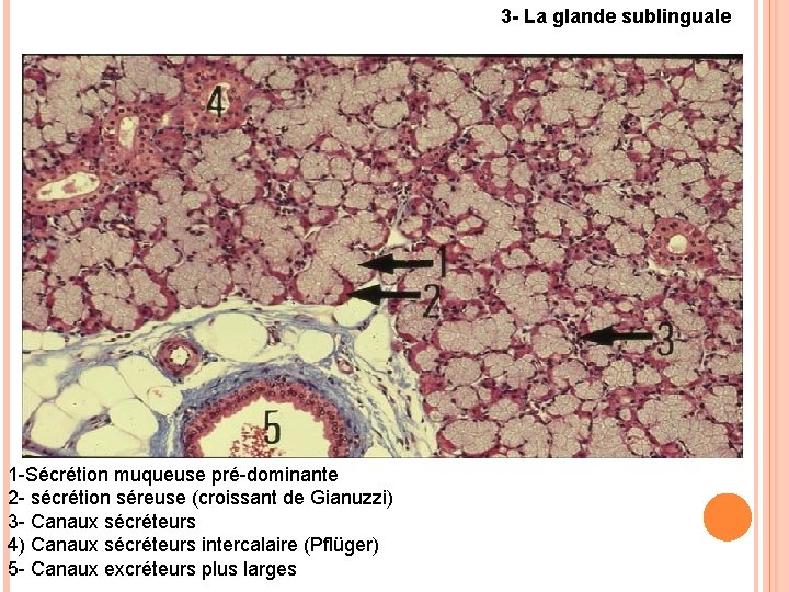 3 - La glande sublinguale 1 -Sécrétion muqueuse pré-dominante 2 - sécrétion séreuse (croissant 3 - La glande sublinguale 1 -Sécrétion muqueuse pré-dominante 2 - sécrétion séreuse (croissant