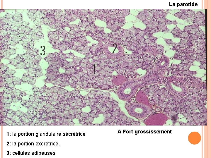 La parotide 1: la portion glandulaire sécrétrice 2: la portion excrétrice. 3: cellules adipeuses La parotide 1: la portion glandulaire sécrétrice 2: la portion excrétrice. 3: cellules adipeuses