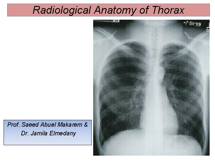 Radiological Anatomy of Thorax Prof. Saeed Abuel Makarem & Dr. Jamila Elmedany 