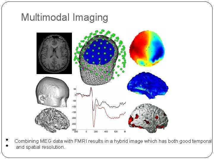 Multimodal Imaging • • Combining MEG data with FMRI results in a hybrid image Multimodal Imaging • • Combining MEG data with FMRI results in a hybrid image