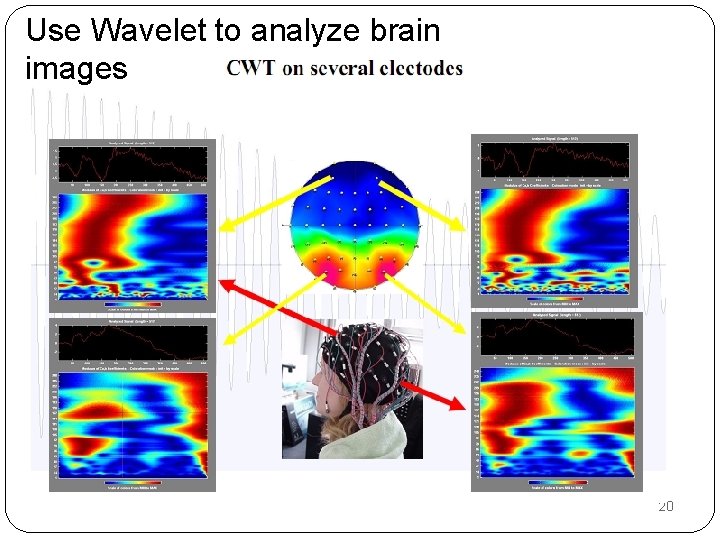 Use Wavelet to analyze brain images 20 Use Wavelet to analyze brain images 20