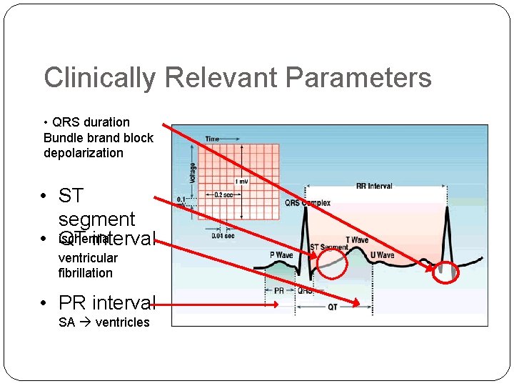 Clinically Relevant Parameters • QRS duration Bundle brand block depolarization • ST segment • Clinically Relevant Parameters • QRS duration Bundle brand block depolarization • ST segment •