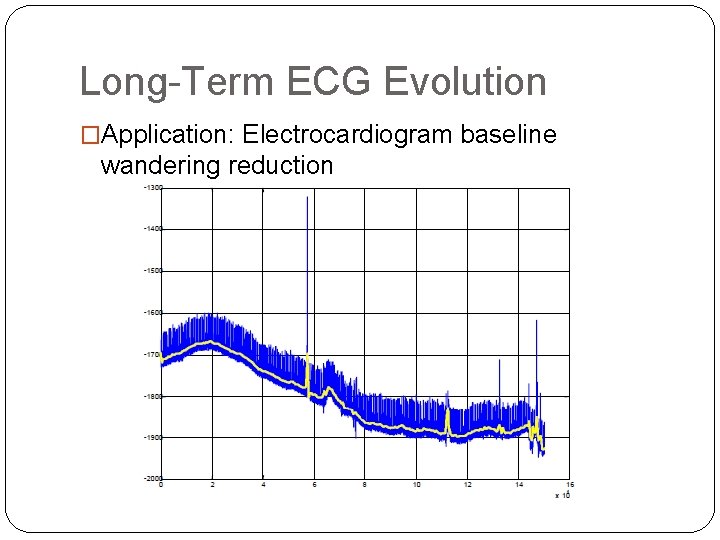 Long-Term ECG Evolution �Application: Electrocardiogram baseline wandering reduction Long-Term ECG Evolution �Application: Electrocardiogram baseline wandering reduction