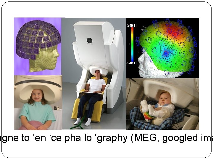 agne to ‘en ‘ce pha lo ‘graphy (MEG, googled ima agne to ‘en ‘ce pha lo ‘graphy (MEG, googled ima