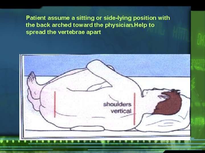 Patient assume a sitting or side-lying position with the back arched toward the physician.