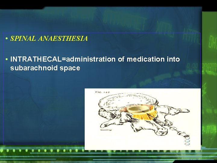  • SPINAL ANAESTHESIA • INTRATHECAL=administration of medication into subarachnoid space 