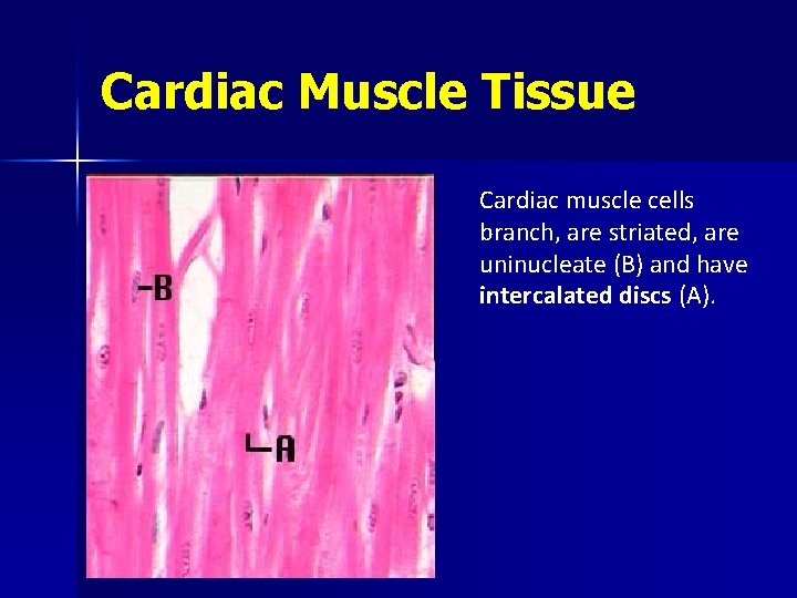 Cardiac Muscle Tissue Cardiac muscle cells branch, are striated, are uninucleate (B) and have