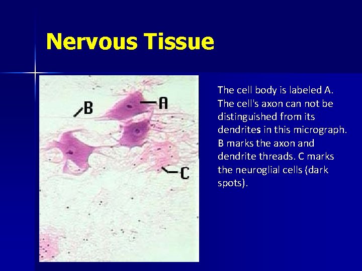 Nervous Tissue The cell body is labeled A. The cell's axon can not be