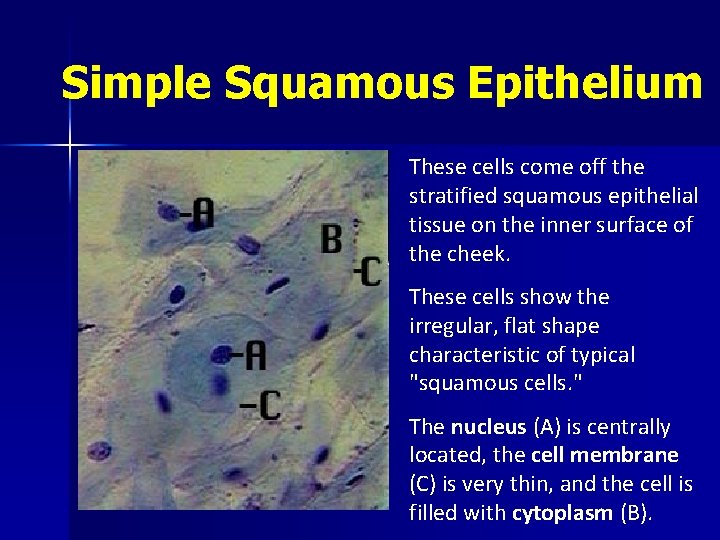 Simple Squamous Epithelium These cells come off the stratified squamous epithelial tissue on the