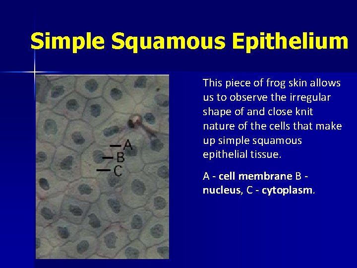 Simple Squamous Epithelium This piece of frog skin allows us to observe the irregular