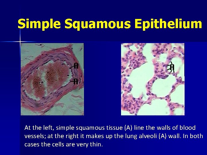 Simple Squamous Epithelium At the left, simple squamous tissue (A) line the walls of