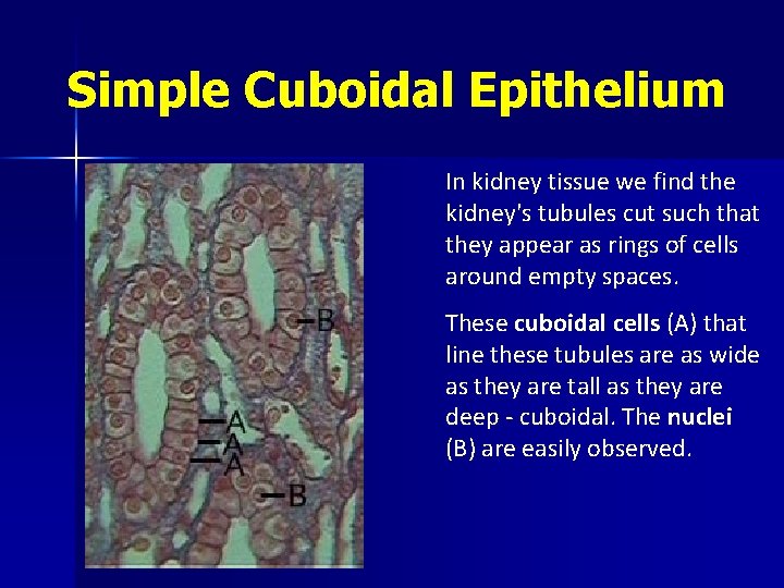 Simple Cuboidal Epithelium In kidney tissue we find the kidney's tubules cut such that