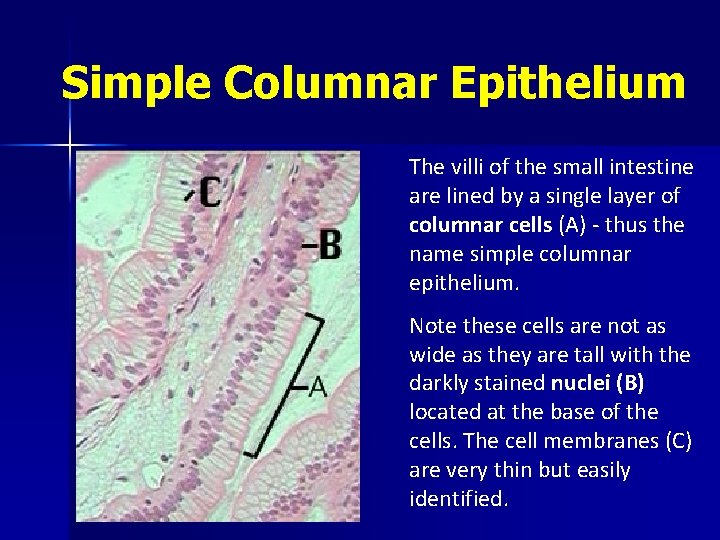 Simple Columnar Epithelium The villi of the small intestine are lined by a single