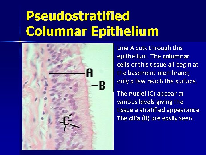 Pseudostratified Columnar Epithelium Line A cuts through this epithelium. The columnar cells of this