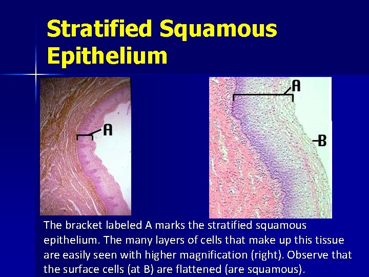 Stratified Squamous Epithelium The bracket labeled A marks the stratified squamous epithelium. The many