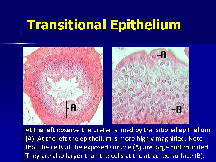Transitional Epithelium At the left observe the ureter is lined by transitional epithelium (A).