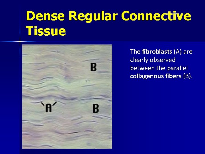 Dense Regular Connective Tissue The fibroblasts (A) are clearly observed between the parallel collagenous