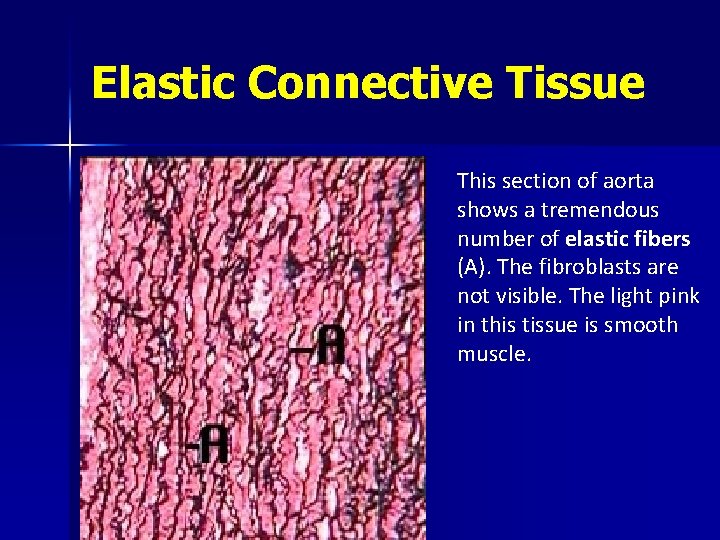 Elastic Connective Tissue This section of aorta shows a tremendous number of elastic fibers