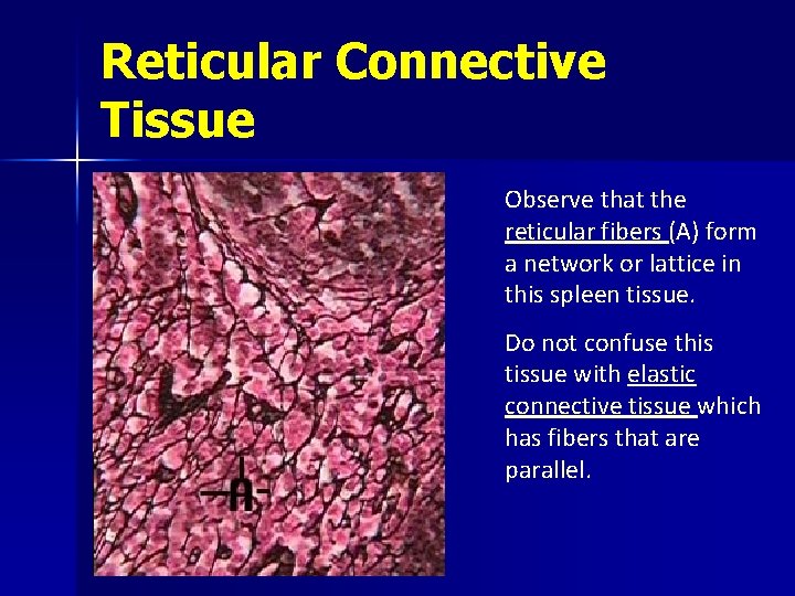Reticular Connective Tissue Observe that the reticular fibers (A) form a network or lattice