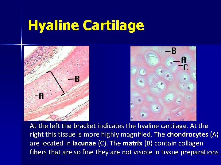 Hyaline Cartilage At the left the bracket indicates the hyaline cartilage. At the right