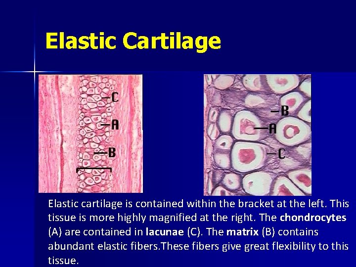 Elastic Cartilage Elastic cartilage is contained within the bracket at the left. This tissue
