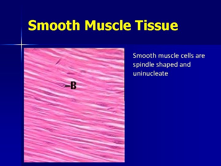 Smooth Muscle Tissue Smooth muscle cells are spindle shaped and uninucleate 