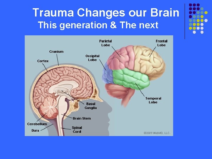 Trauma Changes our Brain This generation & The next 