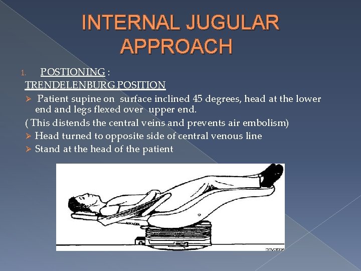 INTERNAL JUGULAR APPROACH POSTIONING : TRENDELENBURG POSITION Ø Patient supine on surface inclined 45