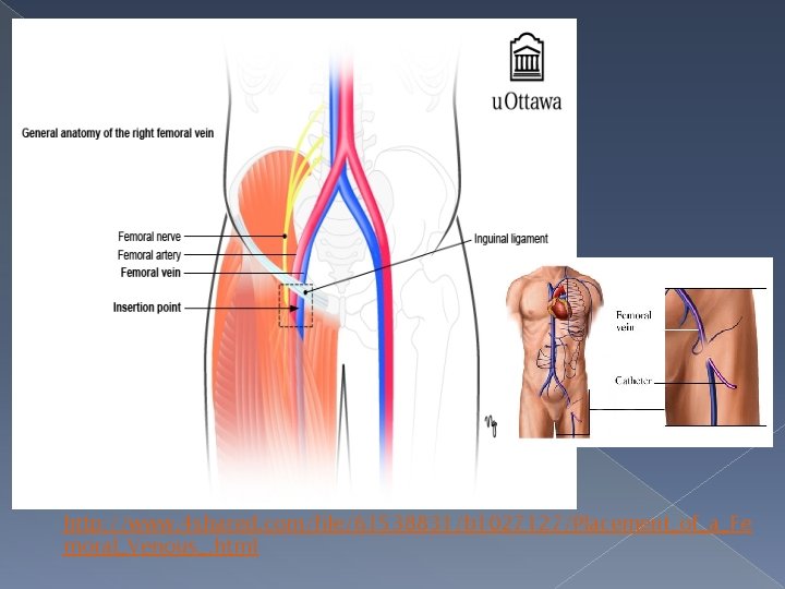 http: //www. 4 shared. com/file/61538831/b 1027127/Placement_of_a_Fe moral_Venous_. html 