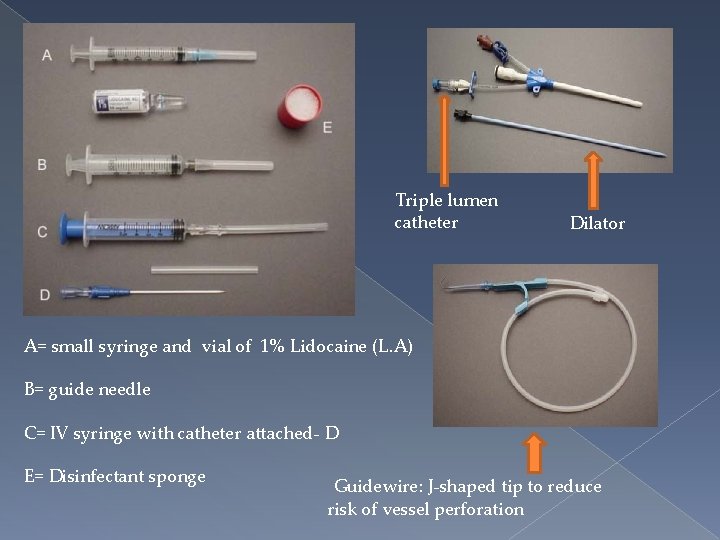 Triple lumen catheter Dilator A= small syringe and vial of 1% Lidocaine (L. A)