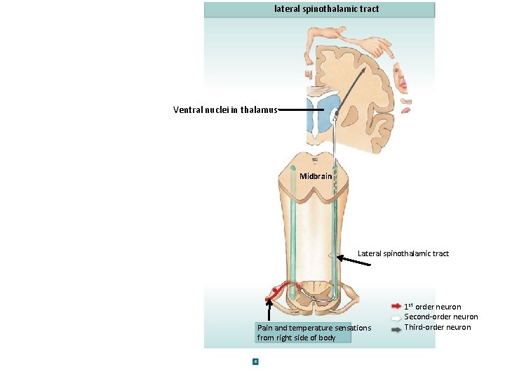 lateral spinothalamic tract Ventral nuclei in thalamus Midbrain Lateral spinothalamic tract Pain and temperature