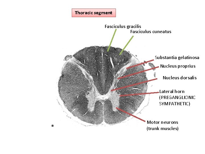 Thoracic segment Fasciculus gracilis Fasciculus cuneatus Substantia gelatinosa Nucleus proprius Nucleus dorsalis Lateral horn