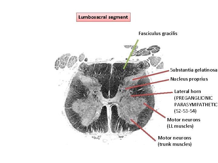 Lumbosacral segment Fasciculus gracilis Substantia gelatinosa Nucleus proprius Lateral horn (PREGANGLIONIC PARASYMPATHETIC (S 2