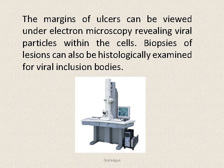 The margins of ulcers can be viewed under electron microscopy revealing viral particles within