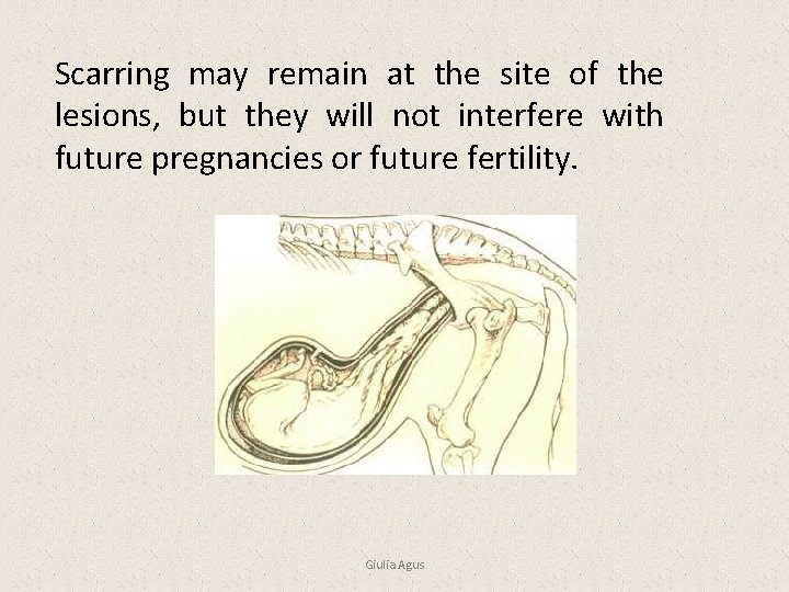 Scarring may remain at the site of the lesions, but they will not interfere