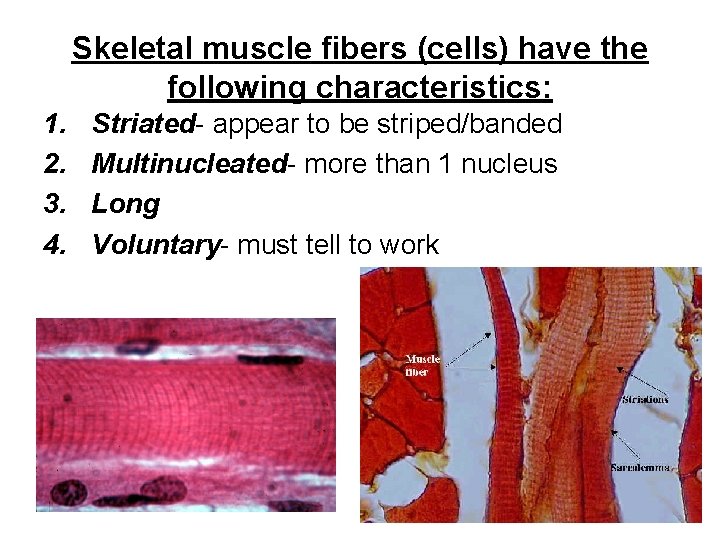 Skeletal muscle fibers (cells) have the following characteristics: 1. 2. 3. 4. Striated- appear