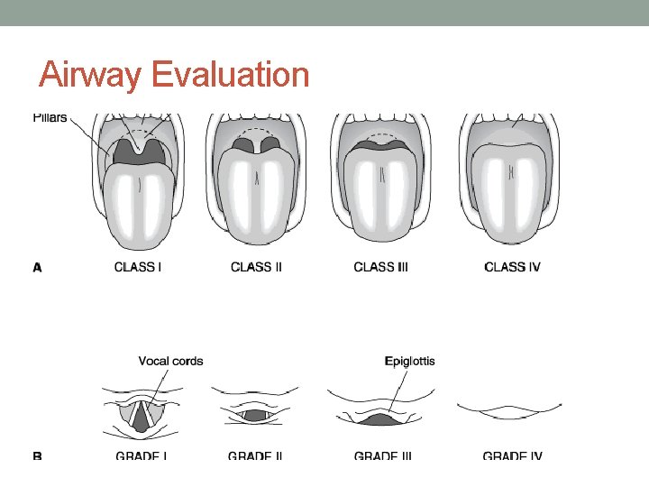 Airway Evaluation 