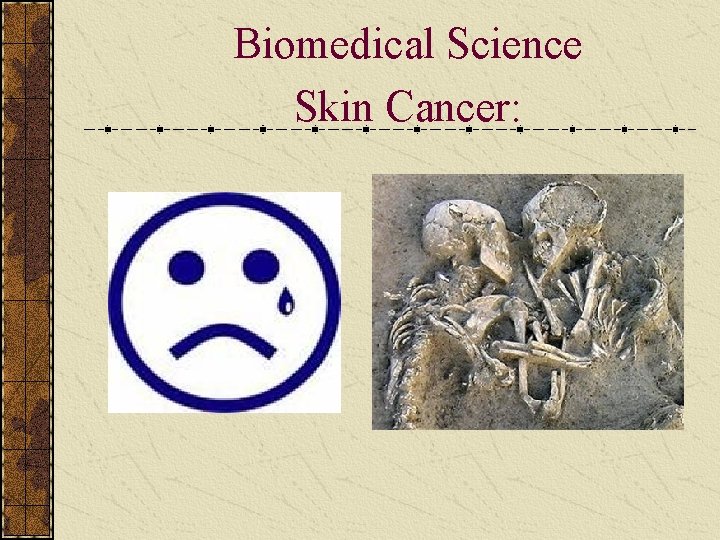 Biomedical Science Skin Cancer: 