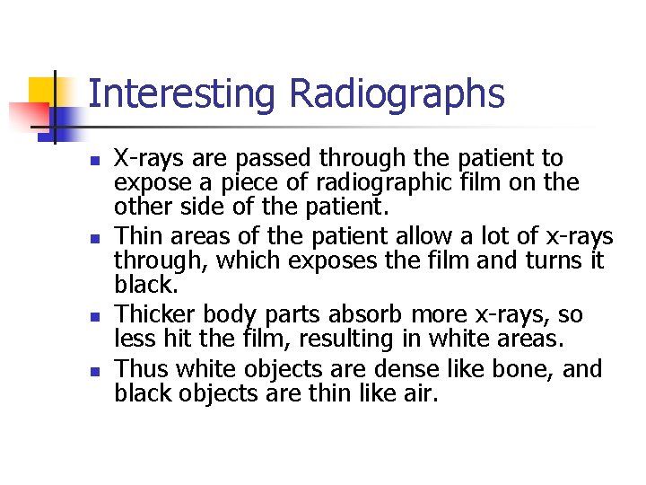 Interesting Radiographs n n X-rays are passed through the patient to expose a piece