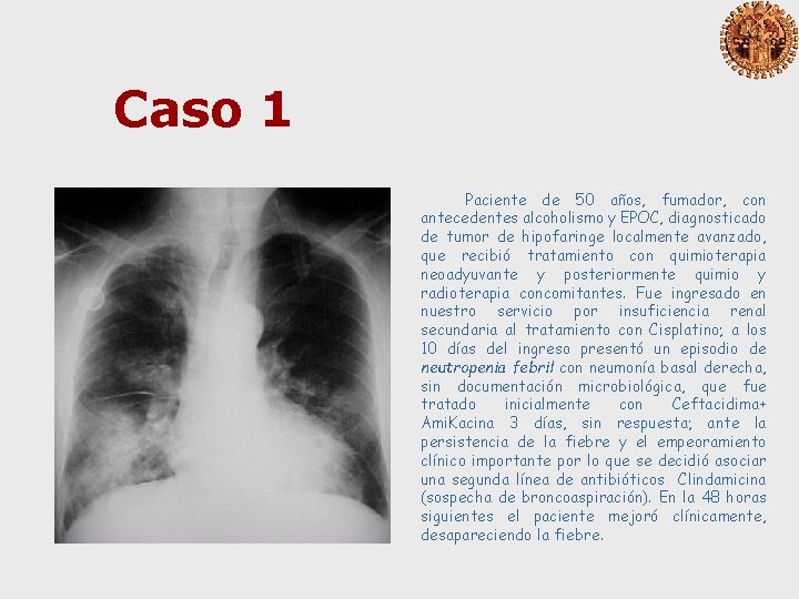 Caso 1 Paciente de 50 años, fumador, con antecedentes alcoholismo y EPOC, diagnosticado de