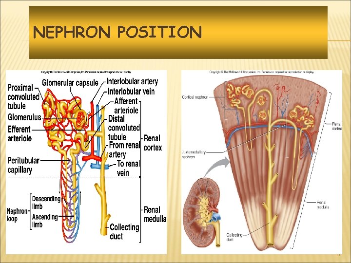 NEPHRON POSITION 17 