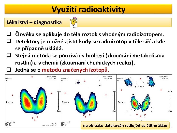 Využití radioaktivity Lékařství – diagnostika q Člověku se aplikuje do těla roztok s vhodným