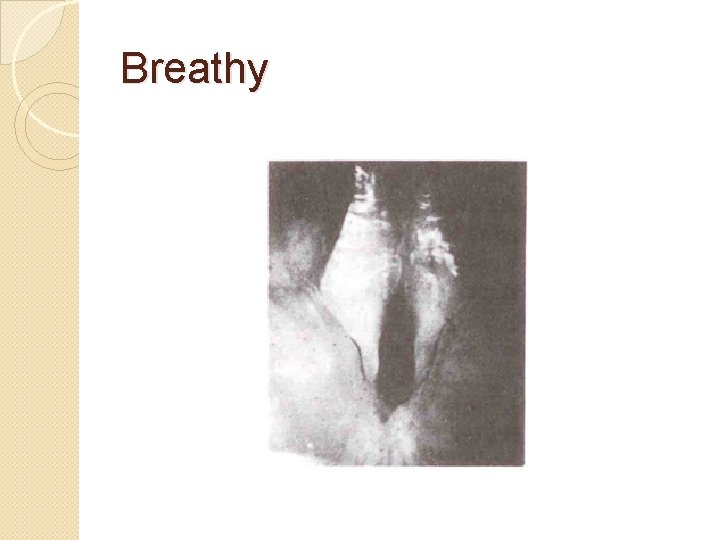 Breathy 