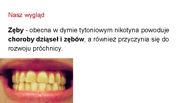 Nasz wygląd Zęby - obecna w dymie tytoniowym nikotyna powoduje choroby dziąseł i zębów,