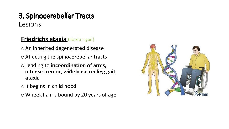 3. Spinocerebellar Tracts Lesions Friedrichs ataxia (ataxia = gait) o An inherited degenerated disease