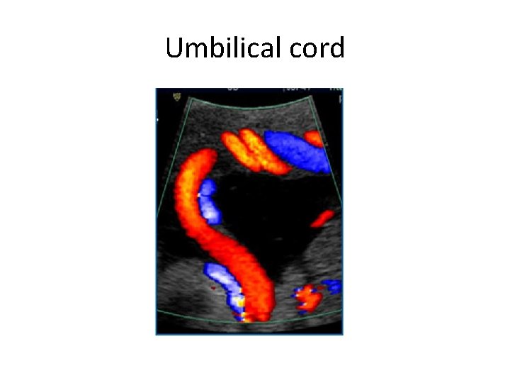 Umbilical cord 