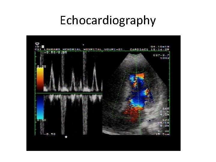 Echocardiography 