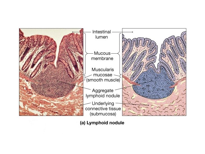 Lymph Nodules 