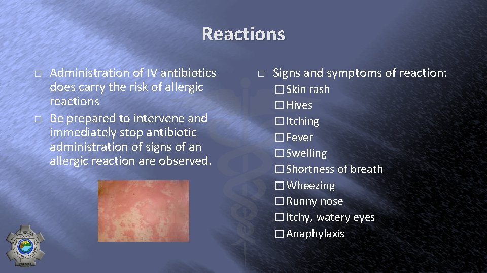 Reactions � � Administration of IV antibiotics does carry the risk of allergic reactions